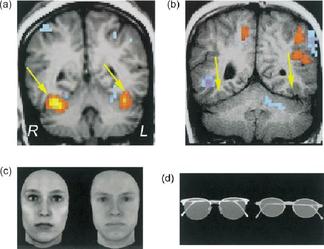 Face‑processing brain activity