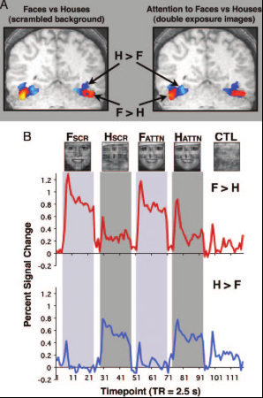 fMRI response graphs